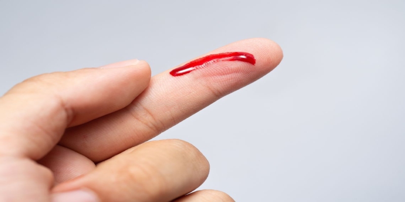 Giải mã mơ thấy máu và những con số may mắn phát tài 6 Mơ thấy máu của người yêu là cảnh báo mâu thuẫn